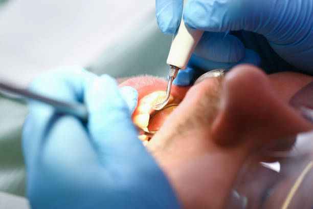 Best Emergency Dental Services for Seniors in Fox River Grove, IL