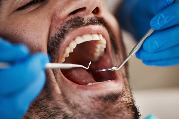 Best Pediatric Emergency Dentist in Fox River Grove, IL