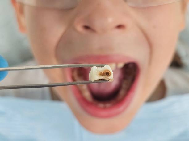 Best Urgent Dental Care for Toothache in Fox River Grove, IL