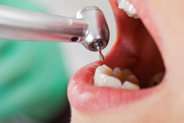 Best Emergency Dentist for Lost Fillings or Crowns in Fox River Grove, IL